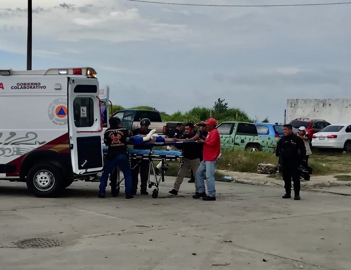 LES EXPLOTA GRANADA DE  FRAGMENTACIÓN EN LAS MANOS